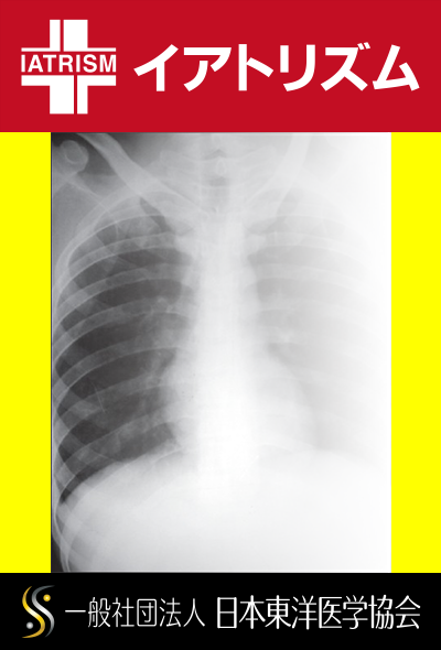 イアトリズム事典 知っておきたい『病院の検査』の生体検査に登場する胸部Ｘ線画像に写る肺や肋骨の風景